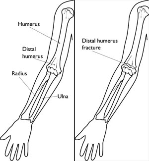 Bones - Anatomy